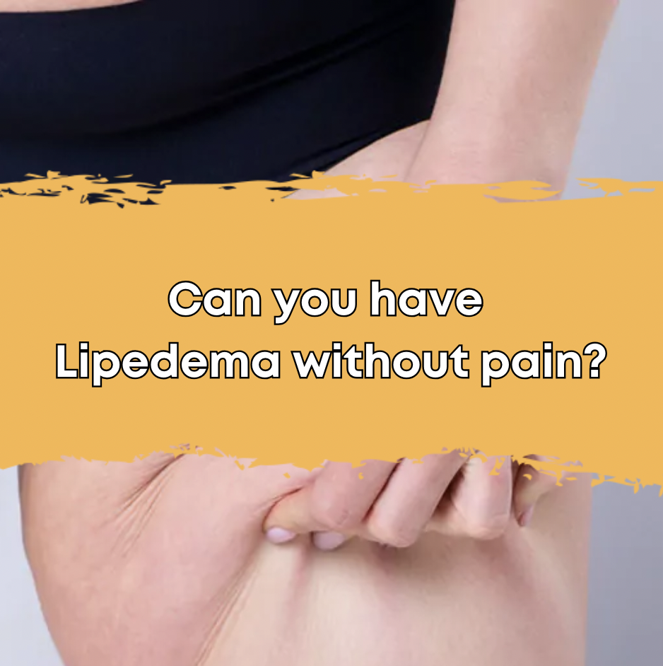 Can you have Lipedema without pain?