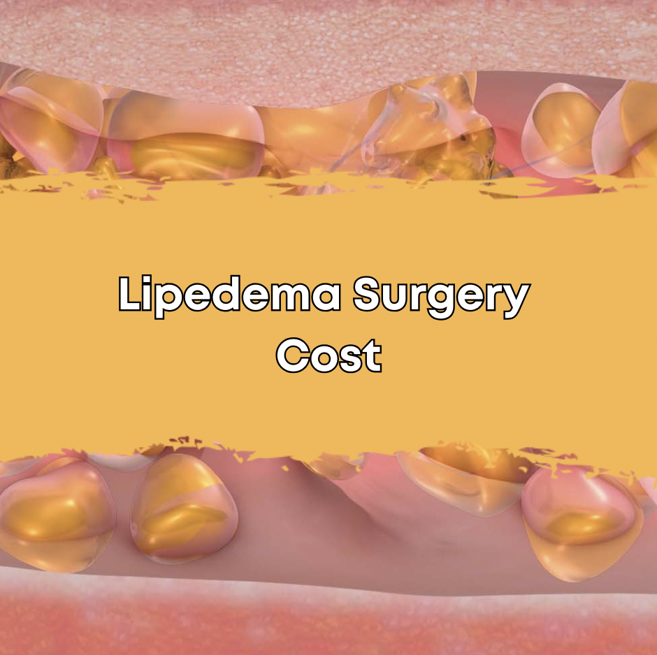 Lipedema Surgery Cost