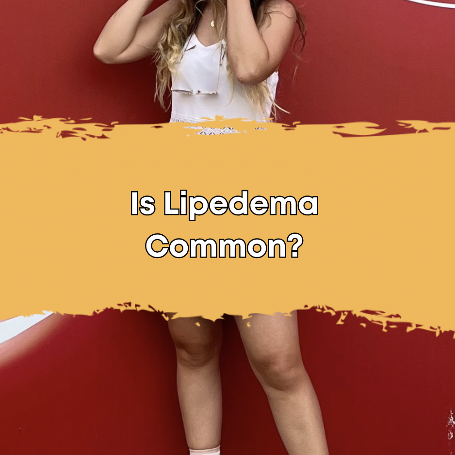 Is Lipedema Common?