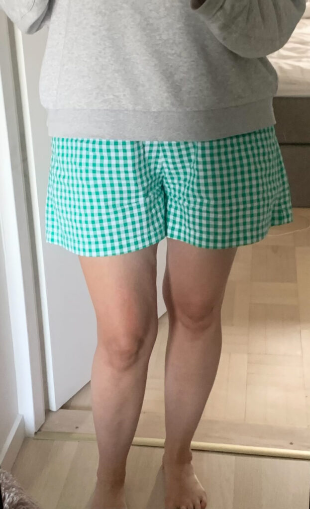 Stage 1 Lipedema Legs
