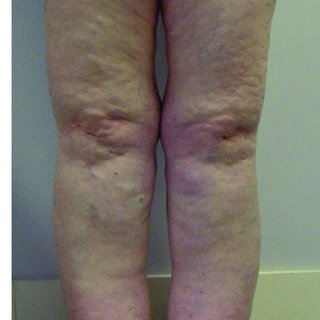 Column Shaped Legs